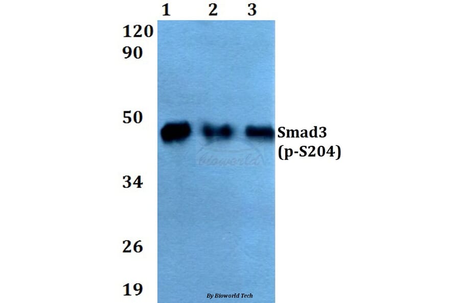 Anti-Smad3 (phospho-S204) Antibody from Bioworld Technology (AP0328) - Antibodies.com