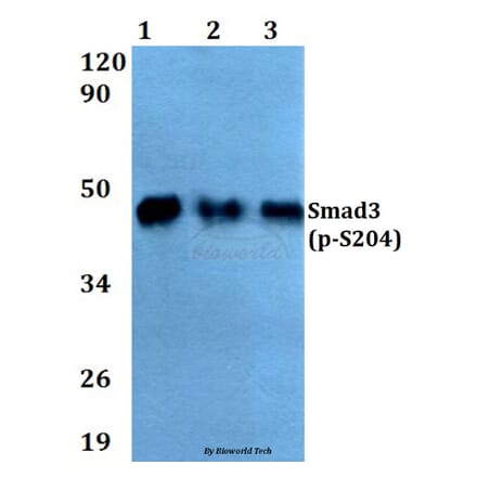Anti-Smad3 (phospho-S204) Antibody from Bioworld Technology (AP0328) - Antibodies.com