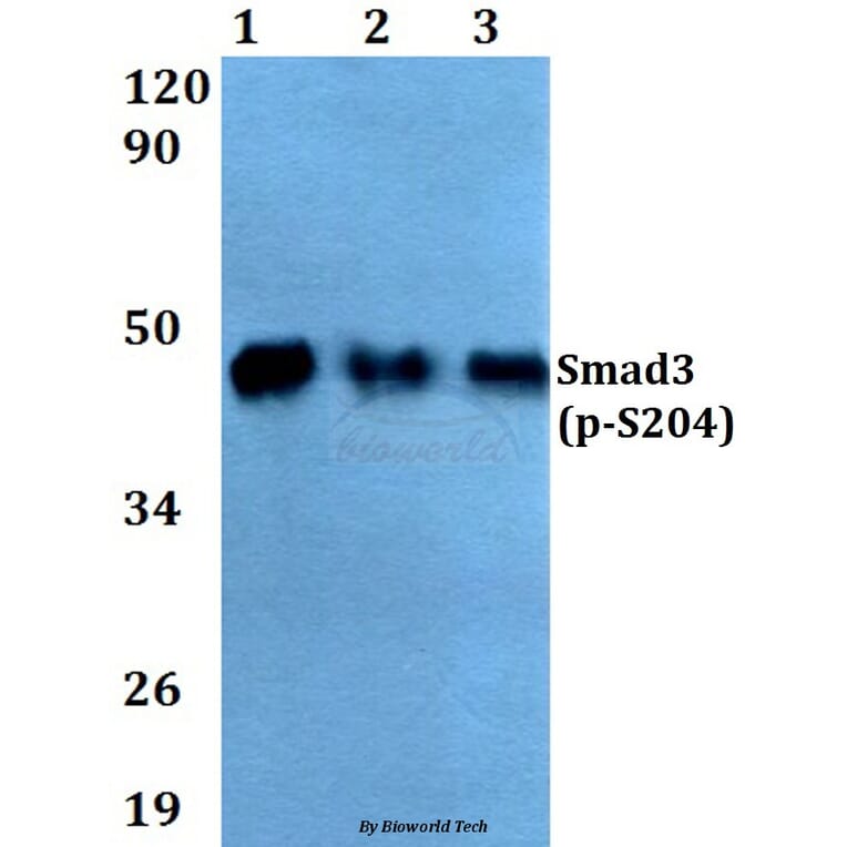 Anti-Smad3 (phospho-S204) Antibody from Bioworld Technology (AP0328) - Antibodies.com