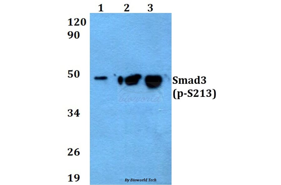 Anti-Smad3 (phospho-S213) Antibody from Bioworld Technology (AP0329) - Antibodies.com