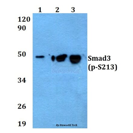 Anti-Smad3 (phospho-S213) Antibody from Bioworld Technology (AP0329) - Antibodies.com