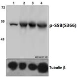 Anti-p-SSB (S366) Antibody from Bioworld Technology (AP0349) - Antibodies.com