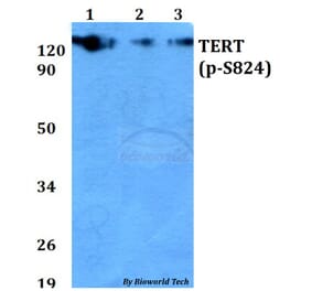 Anti-TERT (phospho-S824) Antibody from Bioworld Technology (AP0350) - Antibodies.com