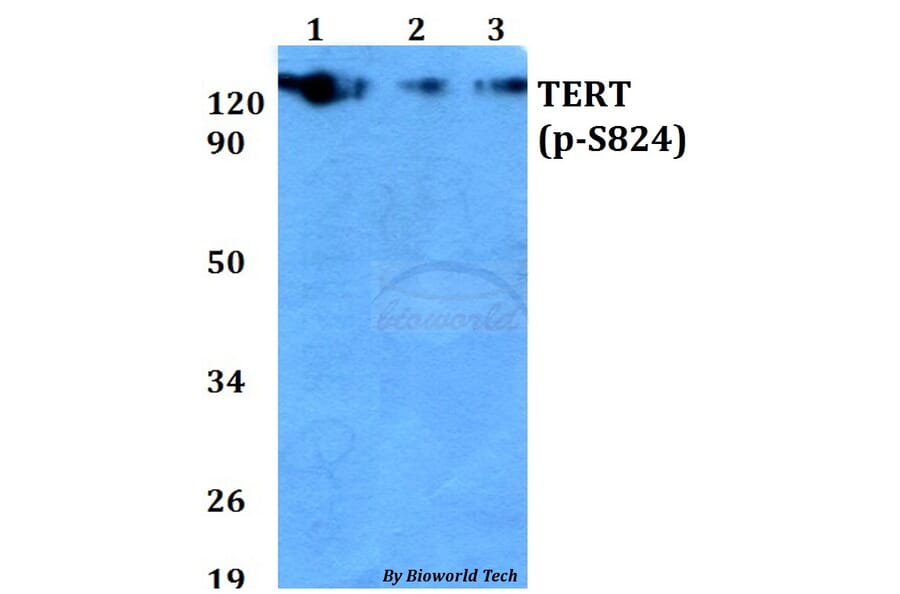 Anti-TERT (phospho-S824) Antibody from Bioworld Technology (AP0350) - Antibodies.com