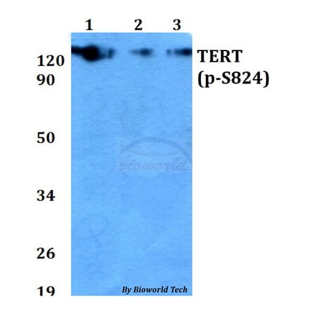 Anti-TERT (phospho-S824) Antibody from Bioworld Technology (AP0350) - Antibodies.com