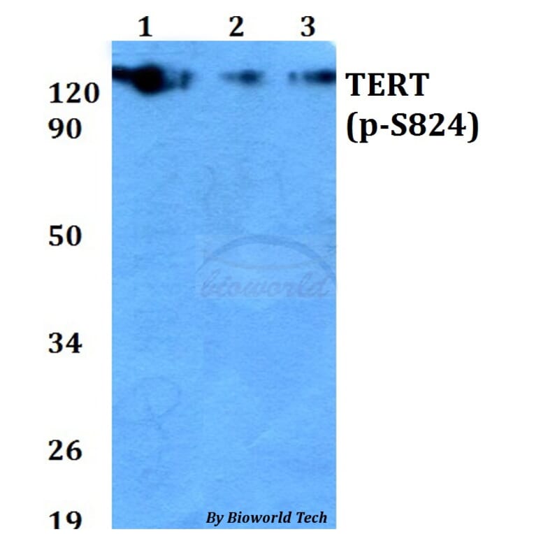 Anti-TERT (phospho-S824) Antibody from Bioworld Technology (AP0350) - Antibodies.com