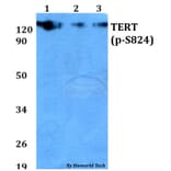 Anti-TERT (phospho-S824) Antibody from Bioworld Technology (AP0350) - Antibodies.com