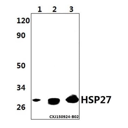 Anti-HSP27 Antibody from Bioworld Technology (AP0362) - Antibodies.com