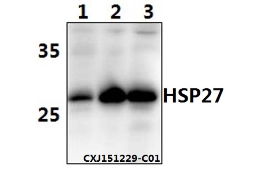 Anti-HSP27 Antibody from Bioworld Technology (AP0362) - Antibodies.com