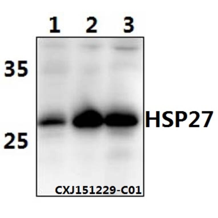 Anti-HSP27 Antibody from Bioworld Technology (AP0362) - Antibodies.com