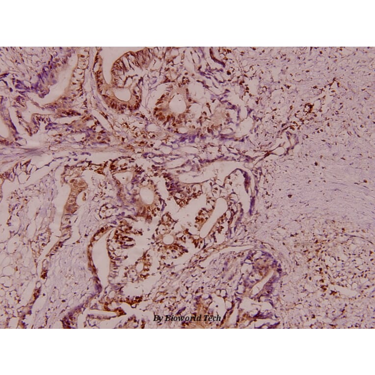 Anti-Stat1 Antibody from Bioworld Technology (AP0364) - Antibodies.com