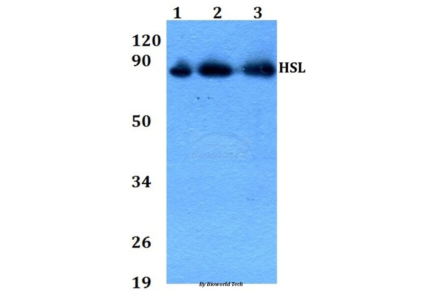Anti-HSL (P548) Antibody from Bioworld Technology (AP0372) - Antibodies.com