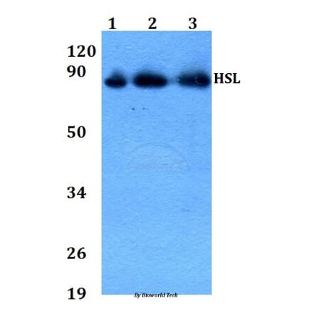 Anti-HSL (P548) Antibody from Bioworld Technology (AP0372) - Antibodies.com
