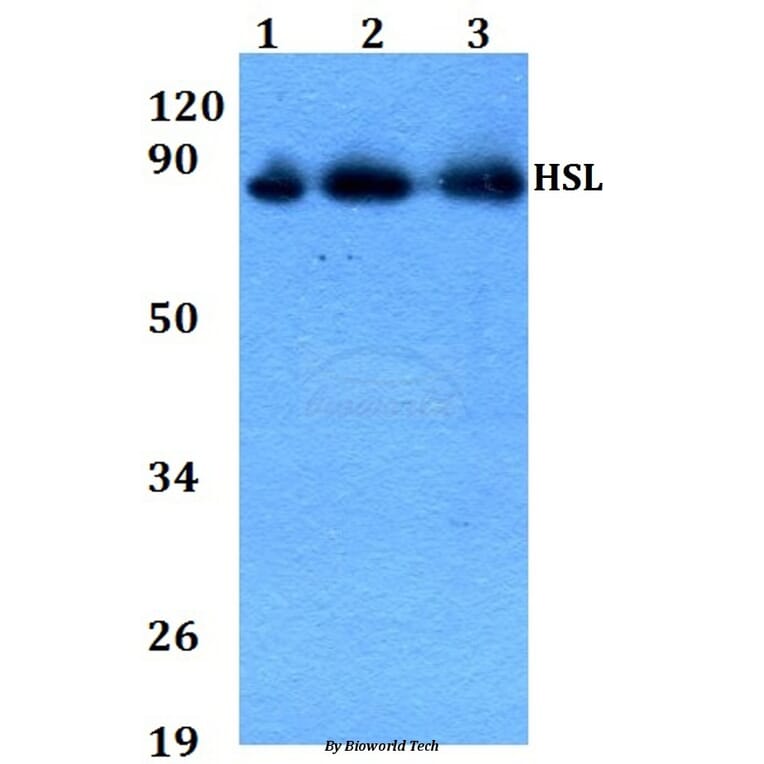Anti-HSL (P548) Antibody from Bioworld Technology (AP0372) - Antibodies.com