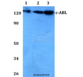 Anti-ABL1 (A198) Antibody from Bioworld Technology (AP0377) - Antibodies.com
