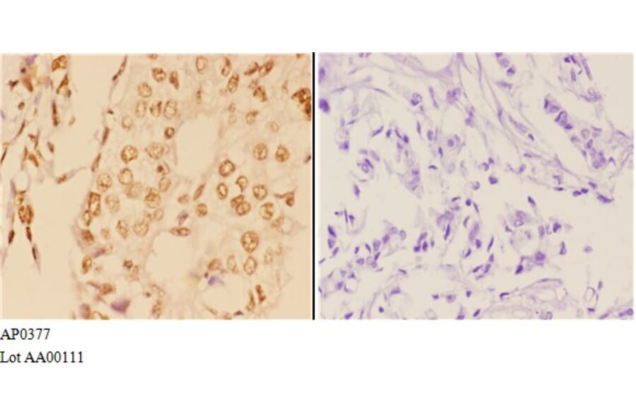 Anti-ABL1 (A198) Antibody from Bioworld Technology (AP0377) - Antibodies.com