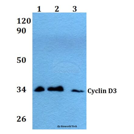 Anti-Cyclin D3 (G277) Antibody from Bioworld Technology (AP0379) - Antibodies.com