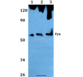 Anti-Fyn (T524) Antibody from Bioworld Technology (AP0381) - Antibodies.com