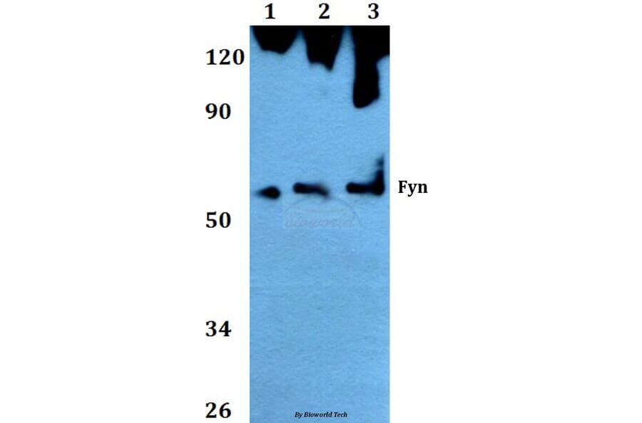 Anti-Fyn (T524) Antibody from Bioworld Technology (AP0381) - Antibodies.com