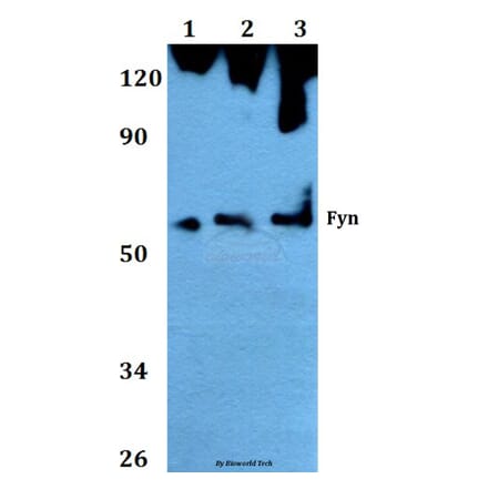 Anti-Fyn (T524) Antibody from Bioworld Technology (AP0381) - Antibodies.com
