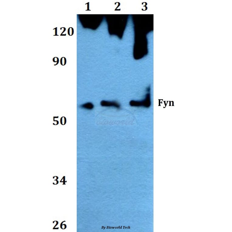 Anti-Fyn (T524) Antibody from Bioworld Technology (AP0381) - Antibodies.com