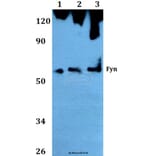 Anti-Fyn (T524) Antibody from Bioworld Technology (AP0381) - Antibodies.com