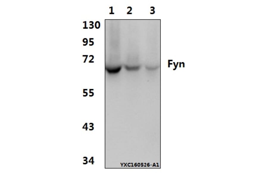 Anti-Fyn (T524) Antibody from Bioworld Technology (AP0381) - Antibodies.com