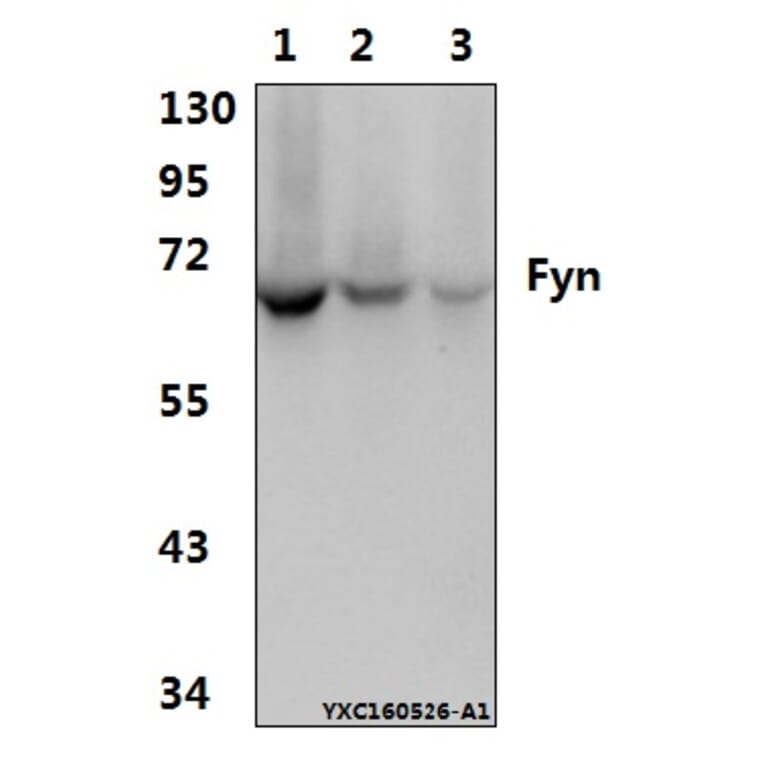 Anti-Fyn (T524) Antibody from Bioworld Technology (AP0381) - Antibodies.com