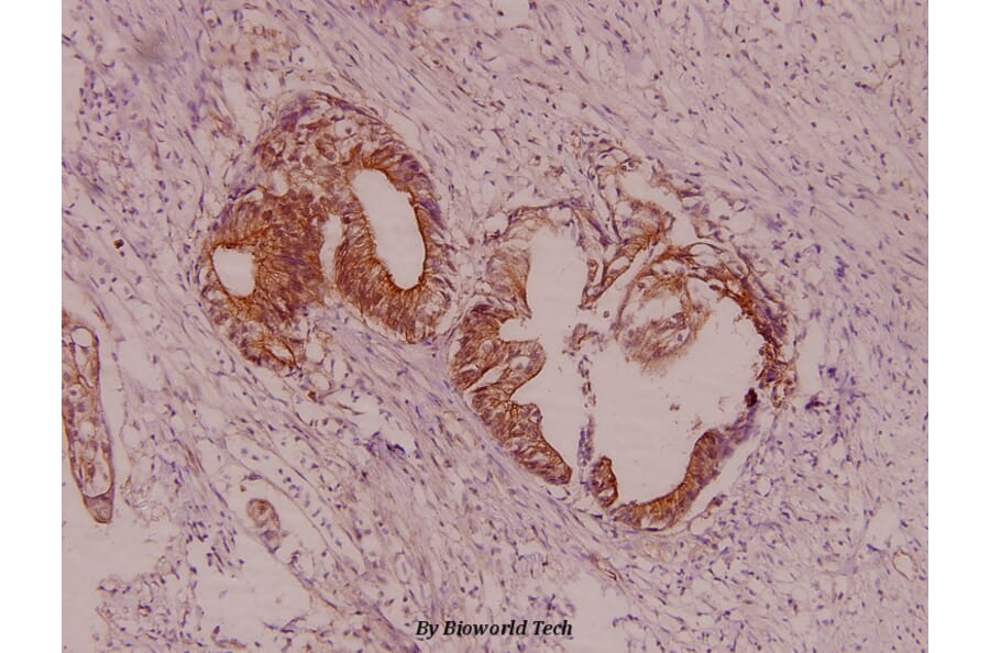 Anti-Fyn (T524) Antibody from Bioworld Technology (AP0381) - Antibodies.com