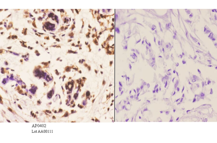 Anti-MEK1 (P293) Antibody from Bioworld Technology (AP0402) - Antibodies.com
