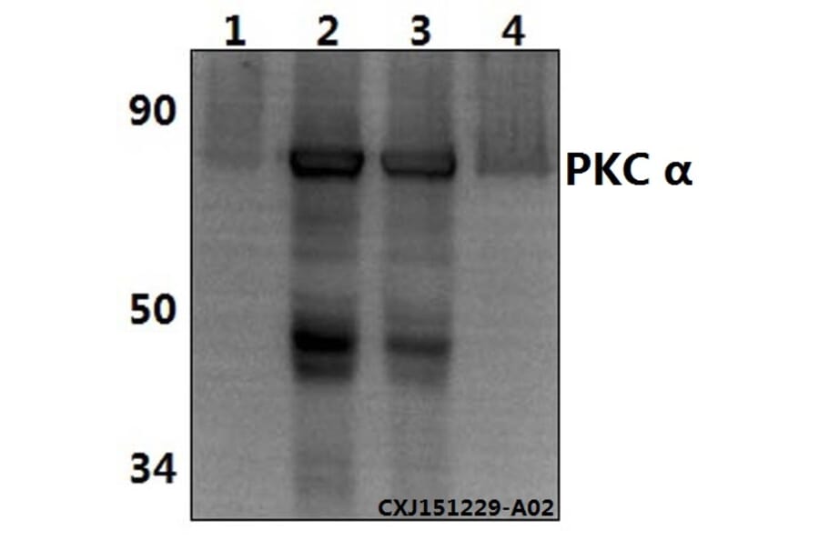 Anti-PKC α (G633) Antibody from Bioworld Technology (AP0408) - Antibodies.com
