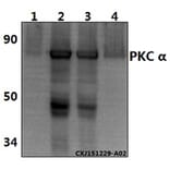 Anti-PKC α (G633) Antibody from Bioworld Technology (AP0408) - Antibodies.com
