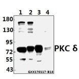 Anti-PKC δ (G499) Antibody from Bioworld Technology (AP0409) - Antibodies.com