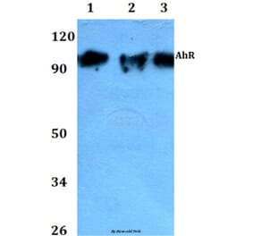 Anti-AhR (K32) Antibody from Bioworld Technology (AP0420) - Antibodies.com