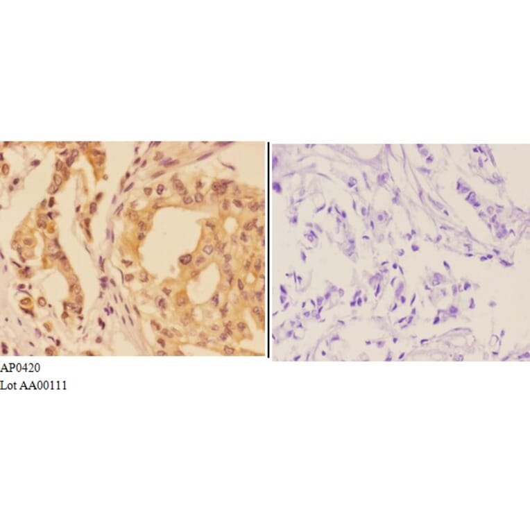 Anti-AhR (K32) Antibody from Bioworld Technology (AP0420) - Antibodies.com