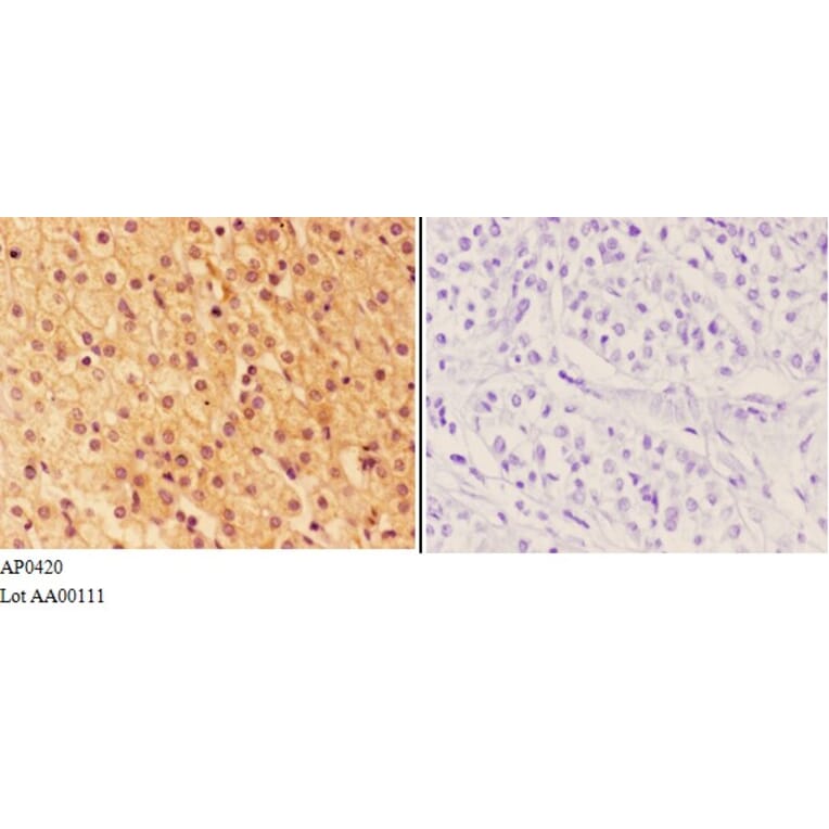 Anti-AhR (K32) Antibody from Bioworld Technology (AP0420) - Antibodies.com