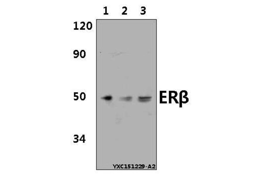 Anti-ERβ (E101) Antibody from Bioworld Technology (AP0436) - Antibodies.com