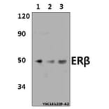 Anti-ERβ (E101) Antibody from Bioworld Technology (AP0436) - Antibodies.com