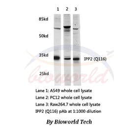 Anti-IPP2(Q116) Antibody from Bioworld Technology (AP0459) - Antibodies.com