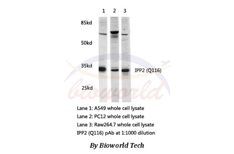 Anti-IPP2(Q116) Antibody from Bioworld Technology (AP0459) - Antibodies.com