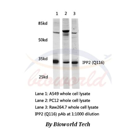 Anti-IPP2(Q116) Antibody from Bioworld Technology (AP0459) - Antibodies.com