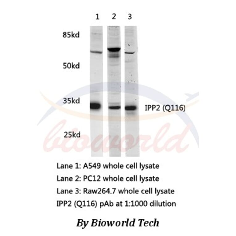 Anti-IPP2(Q116) Antibody from Bioworld Technology (AP0459) - Antibodies.com