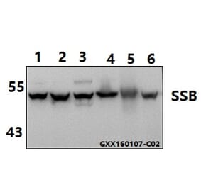 Anti-SSB (T362) Antibody from Bioworld Technology (AP0467) - Antibodies.com