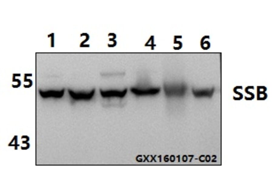 Anti-SSB (T362) Antibody from Bioworld Technology (AP0467) - Antibodies.com