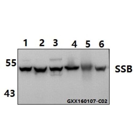 Anti-SSB (T362) Antibody from Bioworld Technology (AP0467) - Antibodies.com