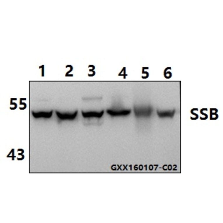 Anti-SSB (T362) Antibody from Bioworld Technology (AP0467) - Antibodies.com