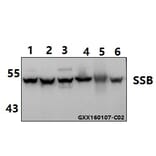 Anti-SSB (T362) Antibody from Bioworld Technology (AP0467) - Antibodies.com