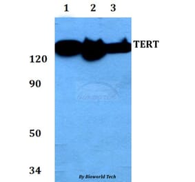 Anti-TERT (I820) Antibody from Bioworld Technology (AP0468) - Antibodies.com