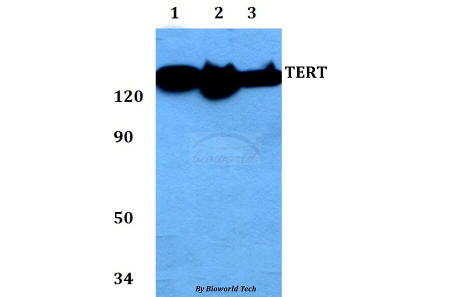 Anti-TERT (I820) Antibody from Bioworld Technology (AP0468) - Antibodies.com