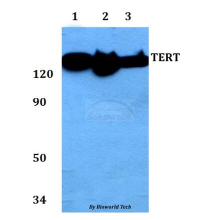 Anti-TERT (I820) Antibody from Bioworld Technology (AP0468) - Antibodies.com